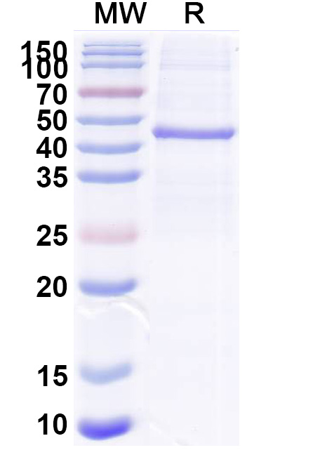 SDS-PAGE for Recombinant PEDV S/Spike glycoprotein Protein, N-His & C-His
