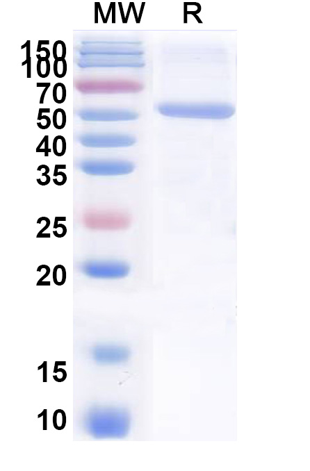 SDS-PAGE for Recombinant PEDV S/Spike glycoprotein Protein, N-His & C-His