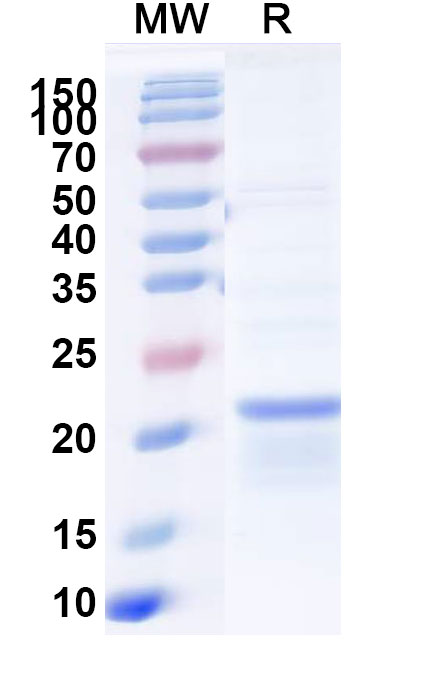 SDS-PAGE for Recombinant Pseudomonas aeruginosa PcrV Protein, N-His
