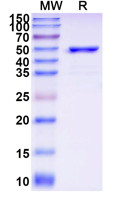 SDS-PAGE for Recombinant Rat AADAT Protein, N-His