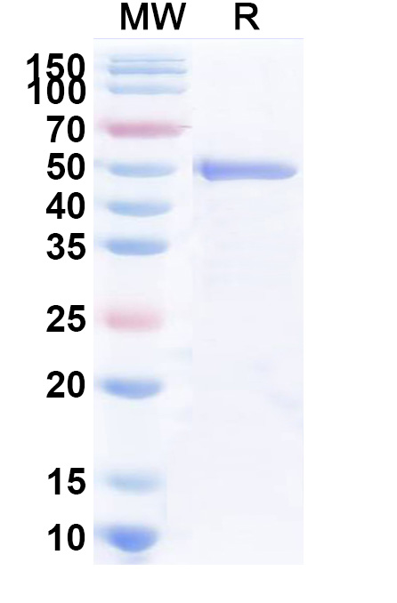 SDS-PAGE for Recombinant Rice ABI5 Protein, N-His