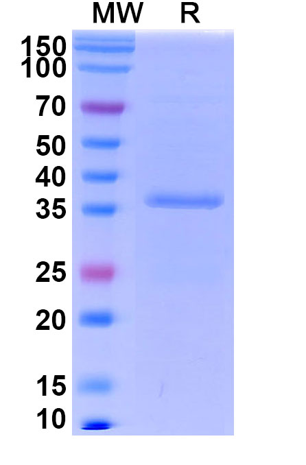 SDS-PAGE for Recombinant Salmonella schwarzengrund murG Protein, C-His
