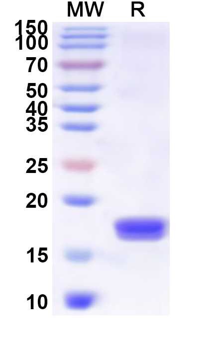 SDS-PAGE for Recombinant Sapporo virus 3CL Protein, N-His