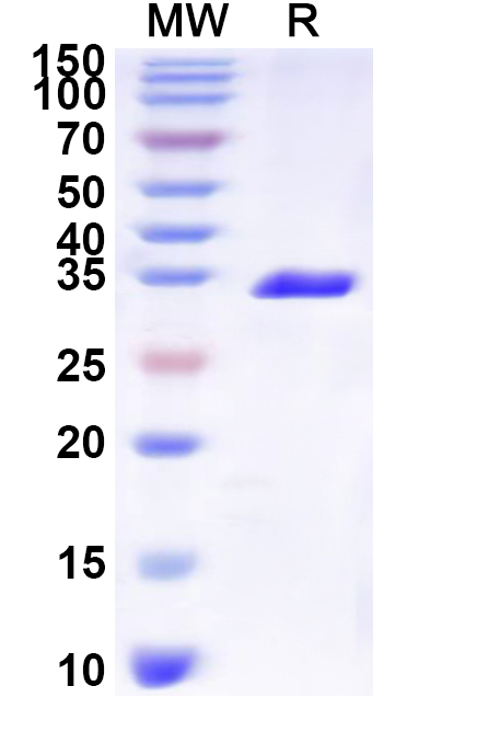 SDS-PAGE for Recombinant Sapporo virus Capsid Protein, N-His