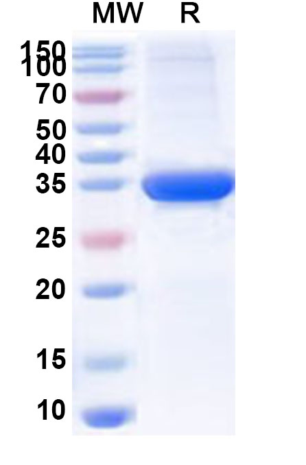 SDS-PAGE for Recombinant Sapporo virus NS1 Protein, N-GST & C-His