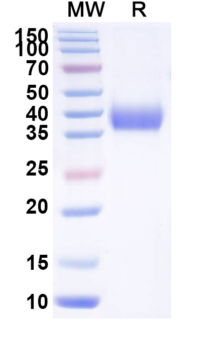 SDS-PAGE for Recombinant SARS-CoV-2 RBD (JN.1) Protein, C-His