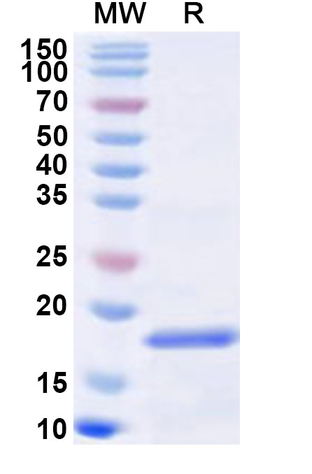 SDS-PAGE for Recombinant Soybean Gly m 4/PR-10 Protein, N-His