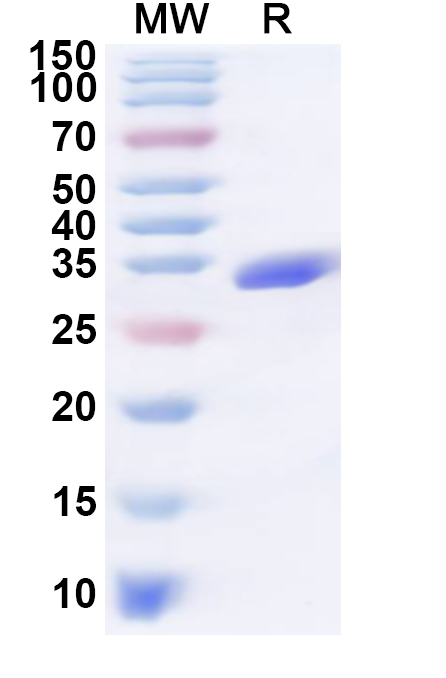 SDS-PAGE for Recombinant Staphylococcus aureus entB/SEB Protein, C-His