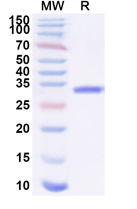 SDS-PAGE for Recombinant Staphylococcus aureus entC2/SEC2 Protein, C-His