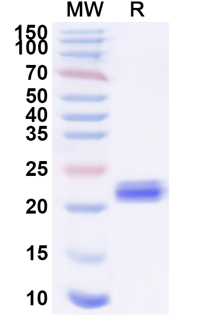 SDS-PAGE for Recombinant Staphylococcus aureus entD/SED Protein, C-His