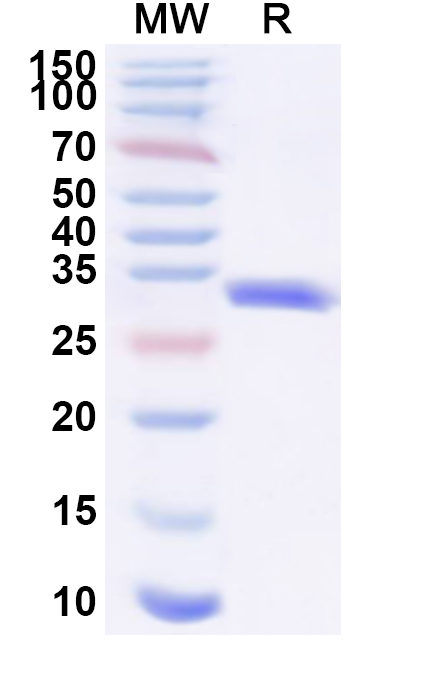 SDS-PAGE for Recombinant Staphylococcus aureus entE/SEE Protein, C-His