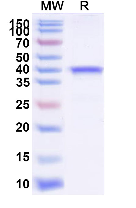 SDS-PAGE for Recombinant Yersinia enterocolitica Invasin Protein, N-His