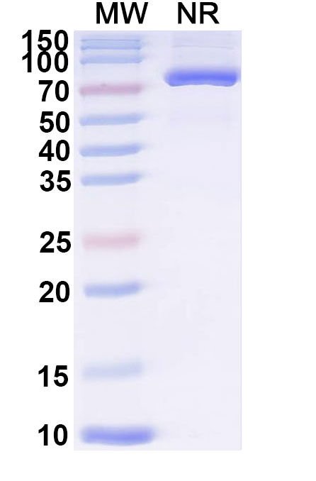 SDS-PAGE for Redalsomatropin Alfa Biosimilar - Research Grade