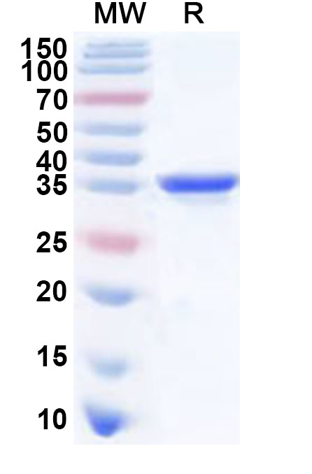 SDS-PAGE for Sindbis virus(SINV) nsp3 Recombinant Protein, N-His
