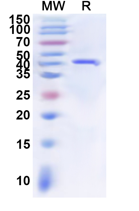 SDS-PAGE for Sindbis virus(SINV) Spike glycoprotein E2, N-His