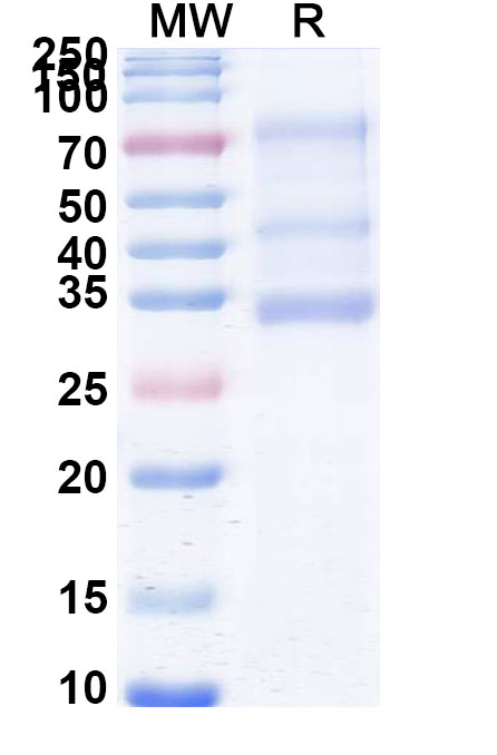 SDS-PAGE for Sozinibercept Biosimilar - Anti-VEGF-C fusion protein - Research Grade