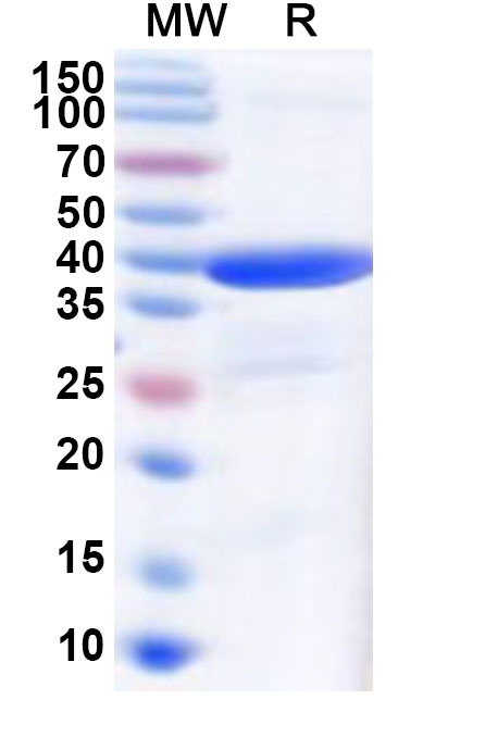 SDS-PAGE for Stable Receptor Related Protein (RAP) LRP1 Inhibitor