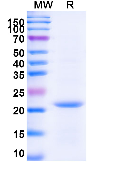 SDS-PAGE for TBP, N-His, recombinant protein