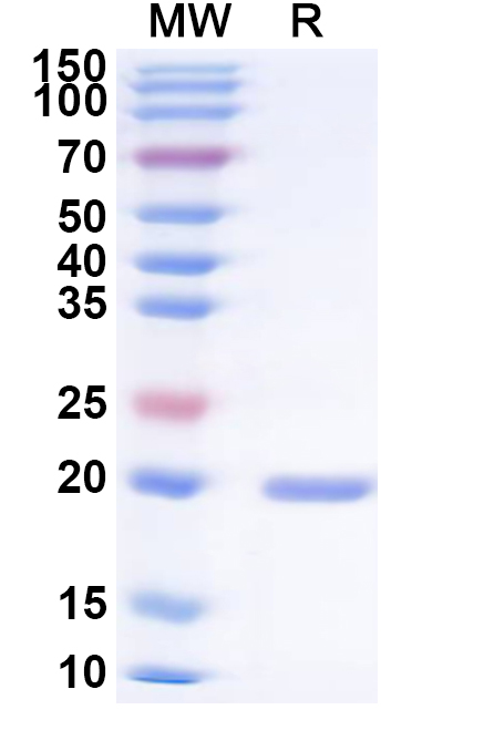 SDS-PAGE for Tobacco mosaic virus(TMV) Capsid/Coat protein, N-His