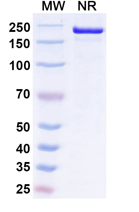 SDS-PAGE for Research Grade Ucenprubart