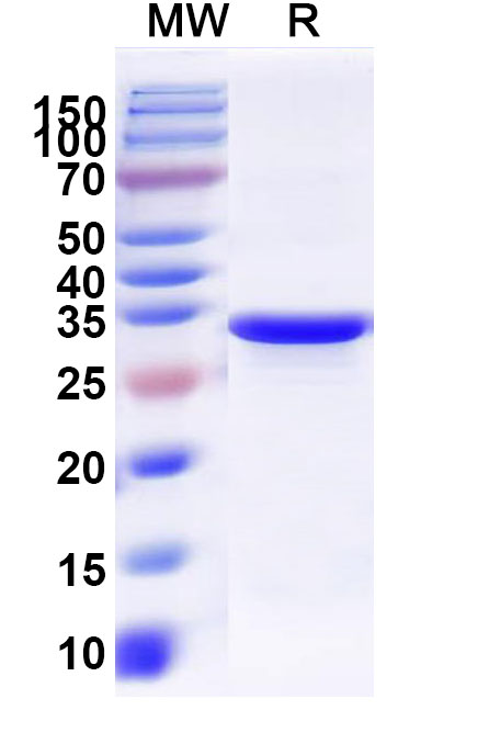 SDS-PAGE for UDP-N-acetylmuramoyl-L-alanyl-D-glutamate--2,6-diaminopimelate ligase(murE)