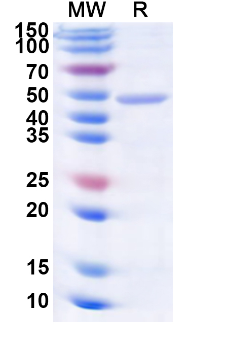 SDS-PAGE for VEEV Spike glycoprotein E1, N-His