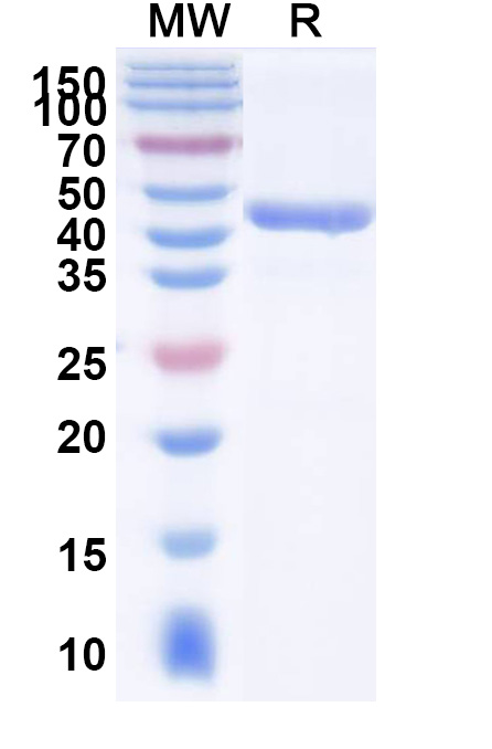 SDS-PAGE for Anti-Human SLC4A7 Monoclonal Antibody (ABS1523)