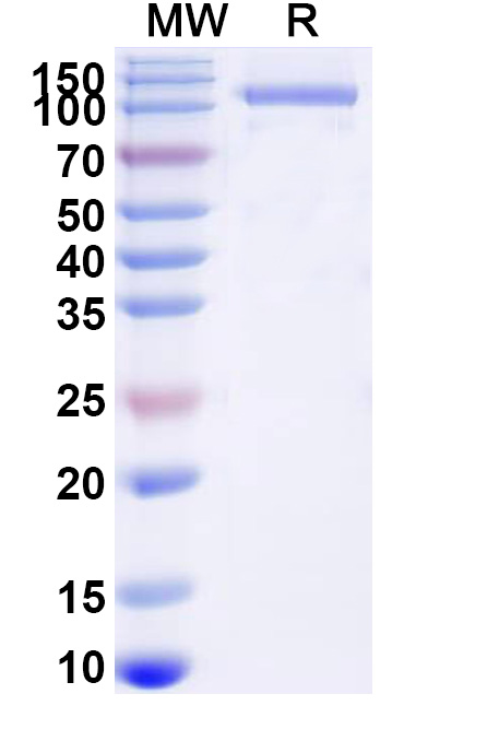 SDS-PAGE for GAA/Aglucosidase Alfa Biosimilar - Anti-GAA - Research Grade