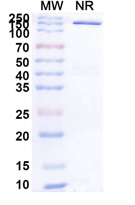 SDS-PAGE for Research Grade Galvokimig