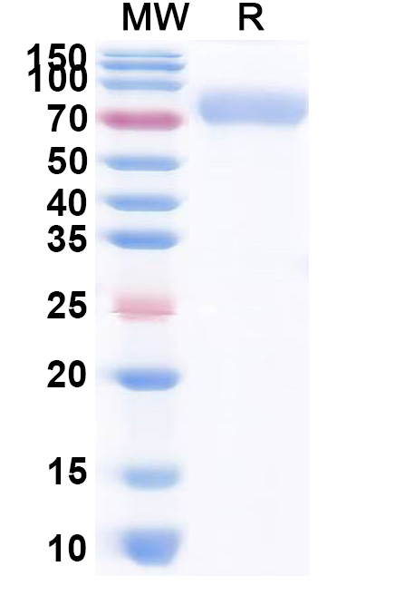 SDS-PAGE for Human CD115 / CSF1R recombinant protein