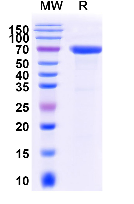 SDS-PAGE for Mouse SFRP5 Recombinant Protein, C-Fc