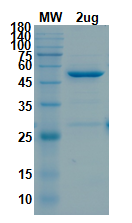 SDS-PAGE for 2'-O-methyltransferase Recombinant proteins