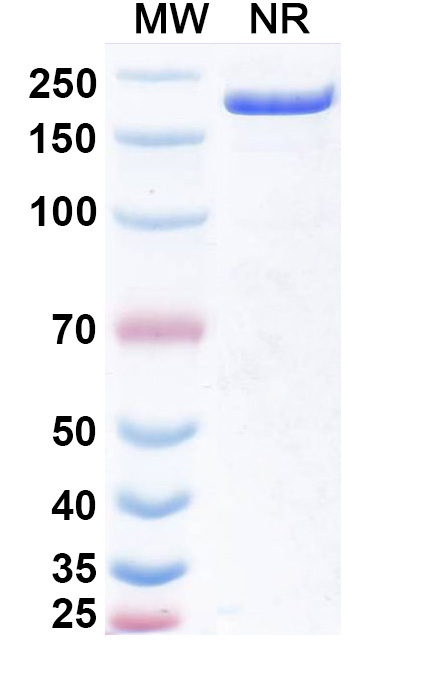 SDS-PAGE for Research Grade Obertamig