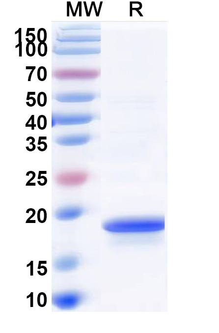 SDS-PAGE for Recombinant CHIKV NPS3 Protein, N-His