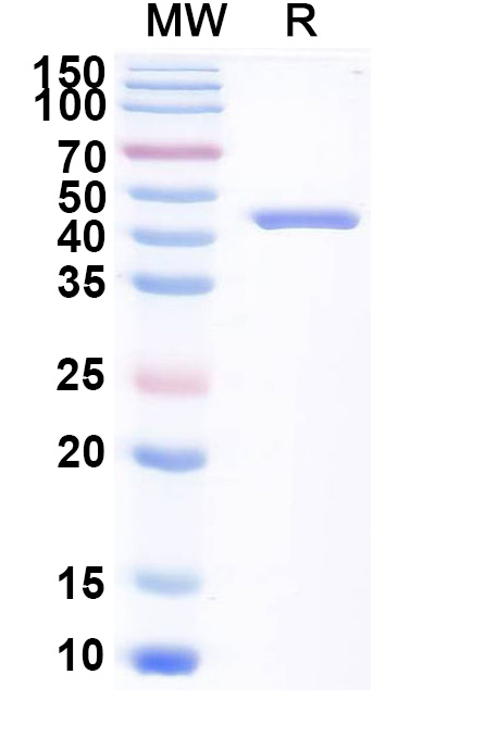 SDS-PAGE for Recombinant Clostridium perfringens plc/Phospholipase C/Alpha-toxin, C-His