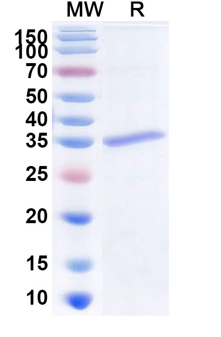SDS-PAGE for Recombinant Cutibacterium acnes PPA2105/Triacylglycerol lipase Protein, N-MAT