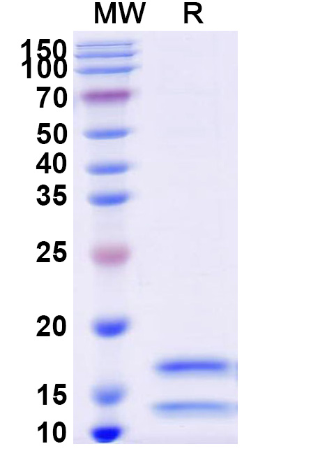 SDS-PAGE for Recombinant Human Calprotectin (S100A8/S100A9) Protein, N-His-Strep