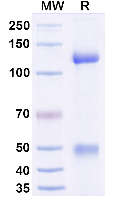 SDS-PAGE for Recombinant Human CRBN & DDB1 Protein, N-Strep & C-His