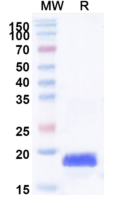 SDS-PAGE for Recombinant Human H3C15, N-His