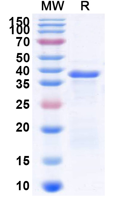 SDS-PAGE for Recombinant Human MIEF1 Protein, N-His