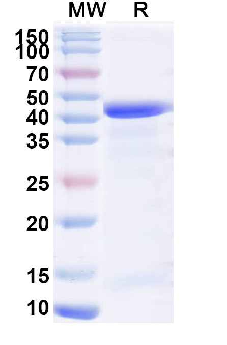 SDS-PAGE for Recombinant Human SIRT6, N-His