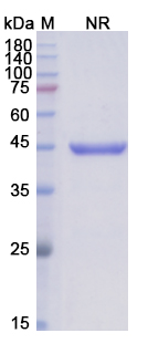 SDS-PAGE for Abciximab Biosimilar - Anti-ITGA2B_ITGB3 mAb