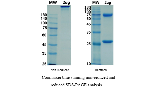 SDS-PAGE for Anti-2019-nCoV(S1)-1 IgM antibody
