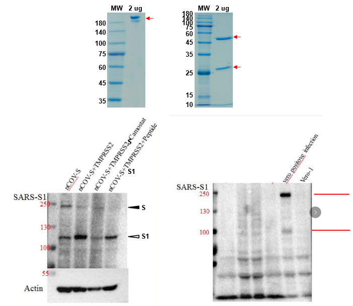 SDS-PAGE for Anti SARS-CoV (2003) antibody - Cross-reacts with COVID-19 - Mouse Fc