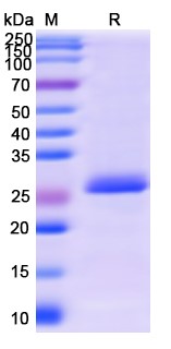 SDS-PAGE for BCR-ABL p210 fusion protein (BCR-ABL fusion)