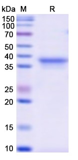 SDS-PAGE for CD126 / IL6R / IL-6RA, N-His, recombinant protein
