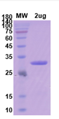 SDS-PAGE For CD19 Protein - Human CD19 recombinant protein