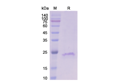 SDS-PAGE for CD20 Protein - Human CD20 Recombinant Protein