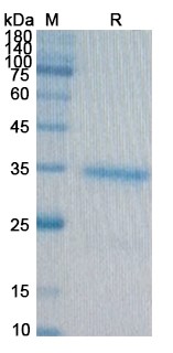 SDS-PAGE for CD91 Recombinant Protein