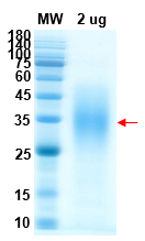 SDS-PAGE for CoV-S[1047-1210] Recombinant proteins